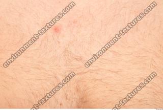 photo texture of hairy skin 0001